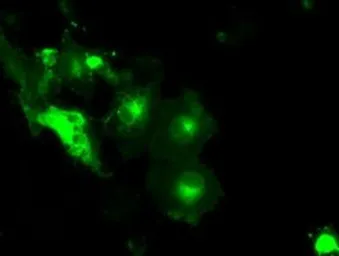 Anti-GLUT5 antibody [14C8] used in Immunocytochemistry/ Immunofluorescence (ICC/IF). GTX83627