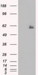 Anti-PPP5C antibody [6F1] used in Western Blot (WB). GTX83838