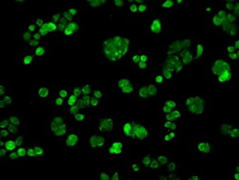 Anti-POR antibody [5H5] used in Immunocytochemistry/ Immunofluorescence (ICC/IF). GTX83859