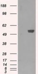 Anti-PFKFB4 antibody [1C8] used in Western Blot (WB). GTX83904