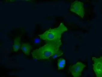 Anti-PFKFB4 antibody [1C8] used in Immunocytochemistry/ Immunofluorescence (ICC/IF). GTX83904