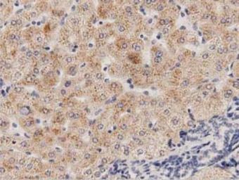 Anti-PECR antibody [2B2] used in IHC (Paraffin sections) (IHC-P). GTX83913