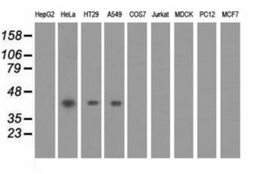 Anti-PAICS antibody [2C9] used in Western Blot (WB). GTX83950