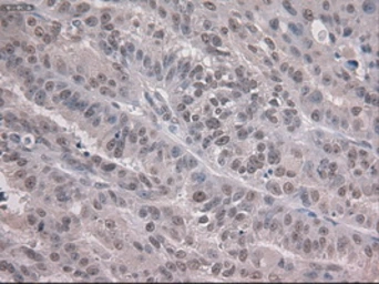 Anti-NOTCH1 antibody [4C9] used in IHC (Paraffin sections) (IHC-P). GTX84020