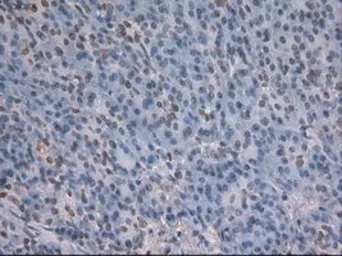 Anti-NOTCH1 antibody [4C9] used in IHC (Paraffin sections) (IHC-P). GTX84020