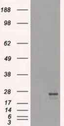 Anti-NAT8 antibody [6H3] used in Western Blot (WB). GTX84062