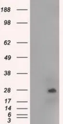 Anti-NAT8 antibody [5A8] used in Western Blot (WB). GTX84063