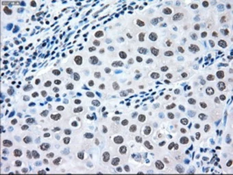 Anti-MEK2 antibody [8G6] used in IHC (Paraffin sections) (IHC-P). GTX84165