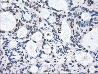 Anti-MEK2 antibody [8G6] used in IHC (Paraffin sections) (IHC-P). GTX84165