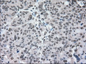 Anti-MEK2 antibody [8G6] used in IHC (Paraffin sections) (IHC-P). GTX84165