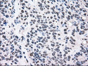 Anti-MEK2 antibody [8G6] used in IHC (Paraffin sections) (IHC-P). GTX84165