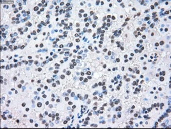 Anti-MEK2 antibody [8G6] used in IHC (Paraffin sections) (IHC-P). GTX84165