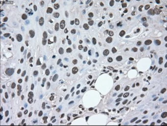 Anti-MEK2 antibody [8G6] used in IHC (Paraffin sections) (IHC-P). GTX84165