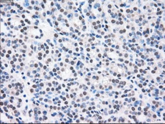 Anti-MEK2 antibody [8G6] used in IHC (Paraffin sections) (IHC-P). GTX84165