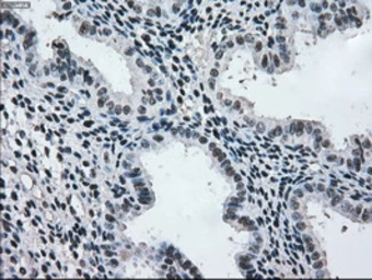 Anti-MEK2 antibody [8G6] used in IHC (Paraffin sections) (IHC-P). GTX84165