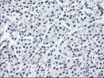 Anti-MEK2 antibody [8G6] used in IHC (Paraffin sections) (IHC-P). GTX84165