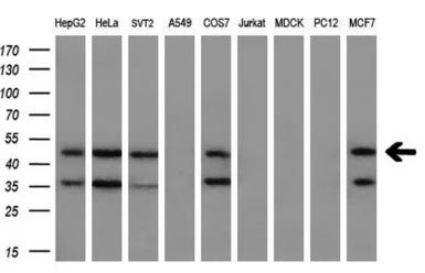 Anti-MEK2 antibody [8G6] used in Western Blot (WB). GTX84165