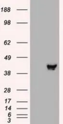 Anti-MEK2 antibody [8G6] used in Western Blot (WB). GTX84165