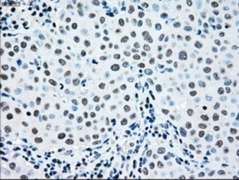 Anti-MEK2 antibody [5F6] used in IHC (Paraffin sections) (IHC-P). GTX84166