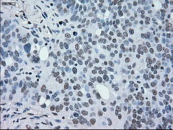 Anti-MEK2 antibody [5F6] used in IHC (Paraffin sections) (IHC-P). GTX84166