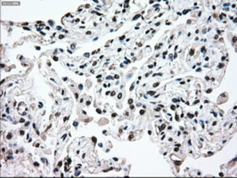 Anti-MEK2 antibody [5F6] used in IHC (Paraffin sections) (IHC-P). GTX84166