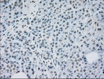 Anti-MEK2 antibody [5F6] used in IHC (Paraffin sections) (IHC-P). GTX84166