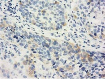 Anti-LIN7B antibody [1C9] used in IHC (Paraffin sections) (IHC-P). GTX84216