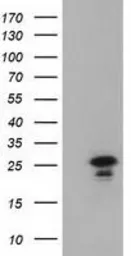 Anti-LIN7B antibody [1C9] used in Western Blot (WB). GTX84216