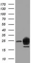 Anti-LIN7B antibody [1F11] used in Western Blot (WB). GTX84218