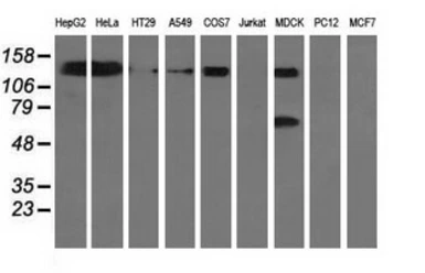 Anti-L1CAM antibody [2G9] used in Western Blot (WB). GTX84232