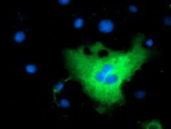 Anti-L1CAM antibody [2G9] used in Immunocytochemistry/ Immunofluorescence (ICC/IF). GTX84232