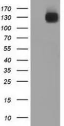 Anti-L1CAM antibody [1A8] used in Western Blot (WB). GTX84236