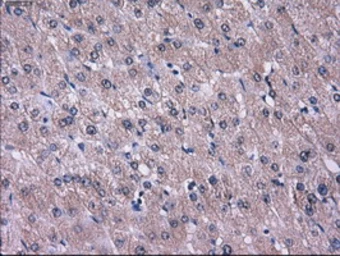 Anti-L1CAM antibody [2C7] used in IHC (Paraffin sections) (IHC-P). GTX84241