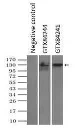 Anti-L1CAM antibody [2C7] used in Immunoprecipitation (IP). GTX84241