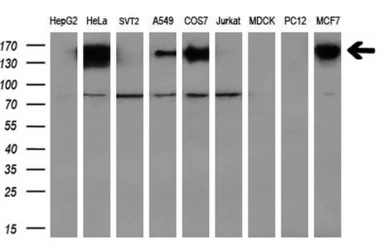 Anti-L1CAM antibody [2C7] used in Western Blot (WB). GTX84241