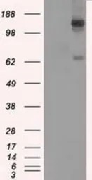 Anti-L1CAM antibody [2C7] used in Western Blot (WB). GTX84241