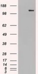 Anti-L1CAM antibody [1H3] used in Western Blot (WB). GTX84244