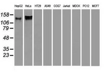 Anti-L1CAM antibody [1H3] used in Western Blot (WB). GTX84244