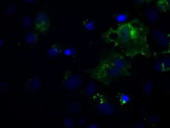 Anti-L1CAM antibody [1H3] used in Immunocytochemistry/ Immunofluorescence (ICC/IF). GTX84244