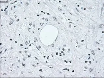 Anti-IRF3 antibody [5D2] used in IHC (Paraffin sections) (IHC-P). GTX84287