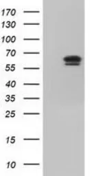 Anti-IGF2BP2 antibody [3G7] used in Western Blot (WB). GTX84303