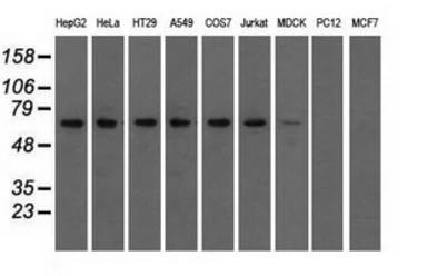 Anti-IGF2BP2 antibody [3G7] used in Western Blot (WB). GTX84303