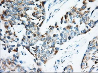 Anti-IGF2BP2 antibody [3F9] used in IHC (Paraffin sections) (IHC-P). GTX84306