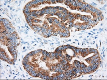 Anti-IGF2BP2 antibody [3F9] used in IHC (Paraffin sections) (IHC-P). GTX84306