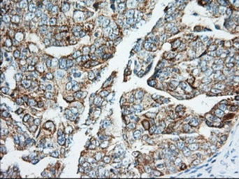 Anti-IGF2BP2 antibody [3F9] used in IHC (Paraffin sections) (IHC-P). GTX84306