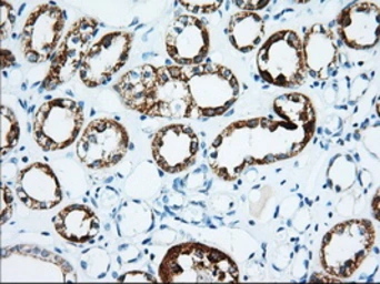 Anti-IGF2BP2 antibody [3F9] used in IHC (Paraffin sections) (IHC-P). GTX84306