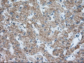 Anti-IGF2BP2 antibody [3F9] used in IHC (Paraffin sections) (IHC-P). GTX84306