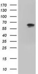 Anti-IGF2BP2 antibody [3F9] used in Western Blot (WB). GTX84306