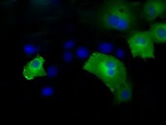 Anti-HIPPI antibody [4F6] used in Immunocytochemistry/ Immunofluorescence (ICC/IF). GTX84310