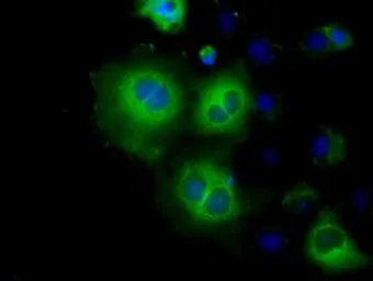 Anti-Hexokinase II antibody [4C5] used in Immunocytochemistry/ Immunofluorescence (ICC/IF). GTX84357